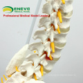 SPINE11 (12383) Medical Anatomy Science Professional Life-Size Vertebral Column with Pelvis and Femur Heads